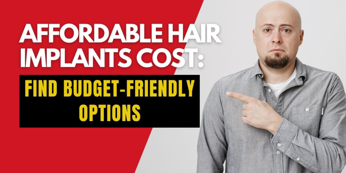 Affordable Hair Implants Cost: Find Budget-Friendly Options